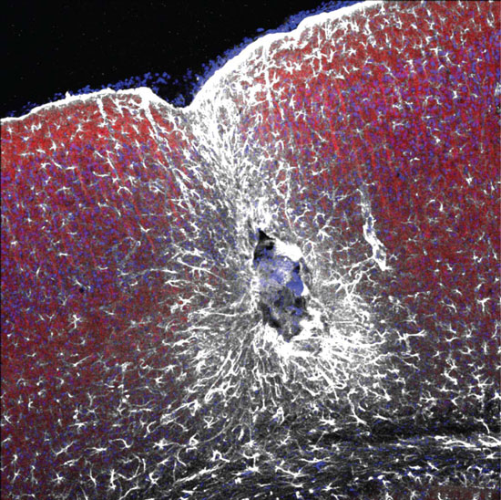 spinal cord